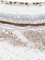Improved Immunohistochemistry of Mouse Eye Sections Using Davidson's Fixative and Melanin Bleaching