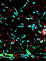 In Vivo Retroviral Transduction of Cardiac Myofibroblasts Using Intramyocardial Injection Immediately Post-myocardial Infarction