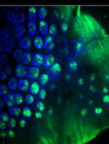 Rapid and solvent-free, 2-hydroxyethyl methacrylate (HEMA)-acrylamide (AAm) copolymer-based optical clearing of tissue for fluorescent imaging
