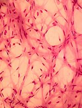 A Simplified 3D-Plasma Culture Method for Generating Minimally Manipulated Autologous Equine Muscle-Derived Progenitor Cells