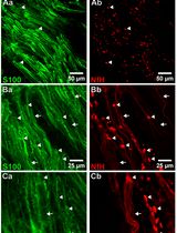 坐骨神经研究中用于可视化区分 A 纤维与 C 纤维的整体免疫染色方法