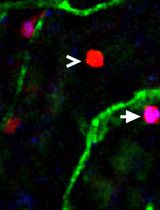 Utilizing EdU to Track Leukocyte Recruitment to the Brain