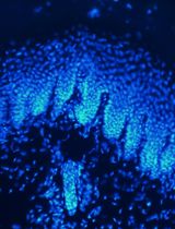 Intraepidermal Nerve Fiber Quantification of the Mouse Hind Paw Footpads: A Detailed and Simplified Protocol