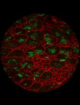 发育中小鼠脑内初级纤毛的整体样本可视化分析