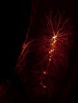 Stimulation-Guided AAV Delivery and Longitudinal Assessment of Optogenetic Expression in Rat Motor Nerves