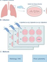用于研究肺部感染与免疫反应的离体肺组织培养模型,以 SARS-CoV-2 为 RNA 病毒研究示例