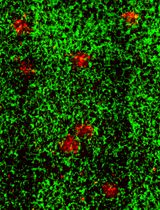 Vascularization of Human Pancreatic Islets With Adaptive Endothelial Cells for In Vitro Analysis and In Vivo Transplantation