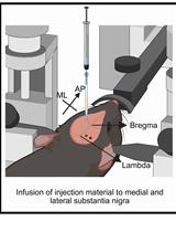 A One-Step Mouse Model of Parkinson’s Disease Combining rAAV-α-Synuclein and Preformed Fibrils of α-Synuclein