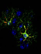 Generating ER-TRG and CA-ER-TRG Knock-in Mice and Quantitative In Vivo Imaging of ER-phagy