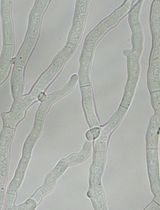 Creating Loss-of-Function Mutants of <em>Neurospora crassa</em> Using a Novel CRISPR/Cas9 System