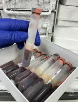 冷冻凝血血液样本中细胞核分离方法