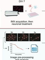 High Content In Vitro Survival Assay of Cortical Neurons
