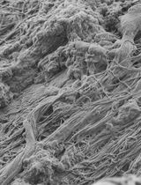 The Generation of Tissue-Specific ECM Hydrogels From Melanoma and Associated Organs to Study Cancer Biology