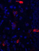 Using Combined Fluorescent In Situ Hybridization With Immunohistochemistry to Co-localize mRNA in Diverse Neuronal Cell Types