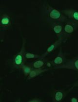 Time-Lapse Into Immunofluorescence Imaging Using a Gridded Dish
