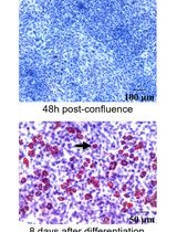 In Vitro Model of Cytokine-Induced Inflammatory 3T3-L1 Adipocytes Mimicking Obesity