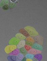 How to Train Custom Cell Segmentation Models Using Cell-APP