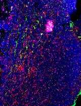 基于免疫荧光的骨髓活检样本原位 mRNA 表达与蛋白同步检测