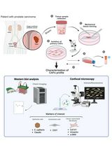 Non-Enzymatic Isolation of Cancer-Associated Fibroblasts From Human Prostate Tumor Explants