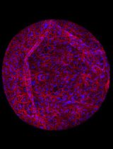 Development, Expansion, and Histological Characterization of Patient-Derived Liver Organoids for Drug Screening and Disease Modeling