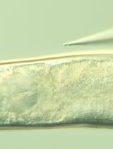 Microinjection of Synthetic Peptides Into Caenorhabditis   elegans