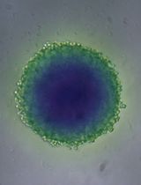 一种简单且低成本的三阴性乳腺癌细胞系（MDA-MB-231）球状体构建方法