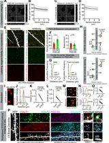 3D STED Super-Resolution Imaging Strategy for Visualizing Synaptic Nano-architecture in Brain Cryosections