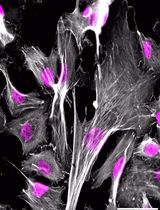 牛肌肉驻留干细胞的分离、培养与分化方法