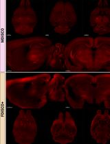 MDISCO: A High-Throughput Tissue-Clearing Protocol for Preservation of Endogenous Fluorescence in Whole Mouse Brains