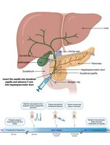 Manipulation of Gene Expression in Mouse Pancreas via Intraductal Delivery of Adeno-Associated Viral Vectors