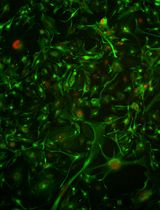 长期冻存后患者来源胶质母细胞瘤细胞的复苏与扩增方法