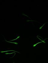 Uptake Assay of Ram Seminal Plasma Extracellular Vesicles to Sperm