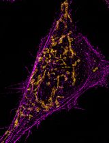 适用于常规宽场表面荧光/全内反射荧光系统的优化 STORM 成像流程