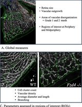 Computational Quantification of Mouse Retinal Vasculature Using ImageJ