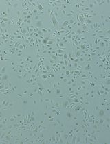 Comprehensive Protocol for Handling Human Small Airway Epithelial Cells (HSAECs) to Establish Air–Liquid Interface (ALI) Cultures With TEER-Based Barrier Integrity Assessment