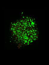 Generation and Characterization of Adaptive Anoikis-Resistant Cells Using Cyclic Attachment-Detachment Culture of Cancer Cells