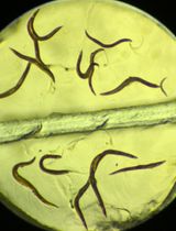 Iodine Staining of Glycogen Storage in <em>Caenorhabditis elegans</em>
