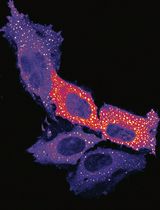 Measuring PINK1 Activity in Single Cells Using a PINK1 Kinase Activity Reporter