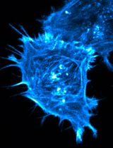 Satellite Cell Isolation, Culture, and Infection After Retroviral Preparation