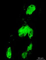 In Vivo Light-Sheet Imaging of Senescence Reporter Activity in a Transparent Killifish