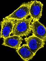 Engineering MRI-Based Programmable Genetic Sensors Using the MAPPER Platform