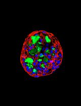 Engineering Decellularized Extracellular Matrix-Incorporated Apical-Out Airway Organoids
