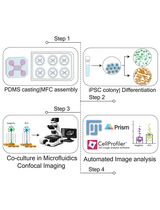 人 iPSC 来源运动神经元—肌管分区共培养体系中轴突变性与 TDP-43 聚集的定量分析