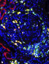 An Automated, Ventana Discovery Platform-based Imaging Workflow for Simultaneous Quantification of B Cells, Plasma Cells, and Plasmablasts in FFPE Human Tissues