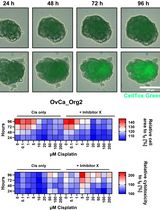Semi-Automated Multiplex Workflow for Functional In Vitro Testing of Chemotherapeutic Treatments in Primary, Patient-Derived Cancer Organoids