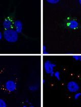 Protecting Against Cytoplasmic Protein Aggregates with Cytoplasmic PML Variants