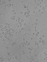 Isolation of Human Umbilical Cord Blood Hematopoietic Stem Cells and Directed Differentiation Into Megakaryocytes