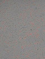 An In Vitro Model to Study Drugs That Affect Macrophage Adhesion to Murine Brain Endothelial Cells After Proinflammatory Insults of LPS and Pilocarpine