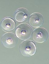 Optimized Phenol–Chloroform–Isoamyl DNA Extraction Protocol for Single Fish Eggs