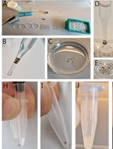 Step-by-Step Protocol for Fluorescence-Based Analysis of Uptake in Transporter-Expressing Xenopus laevis Oocytes